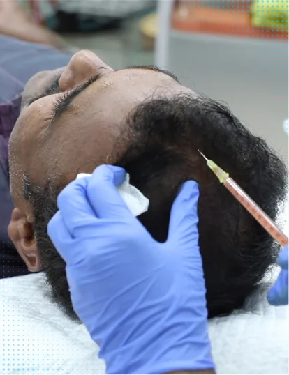 Website_banner_Trichology_PRP