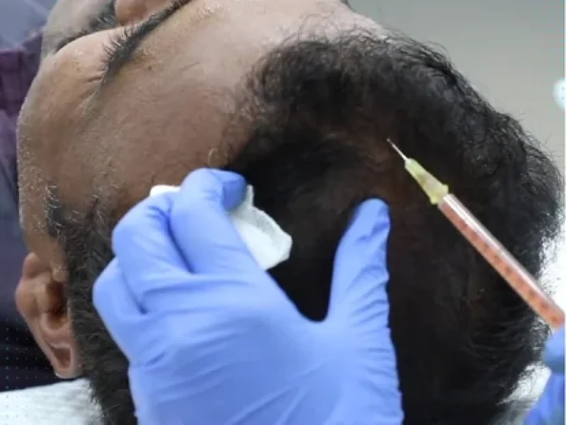 Website_banner_Trichology_PRP